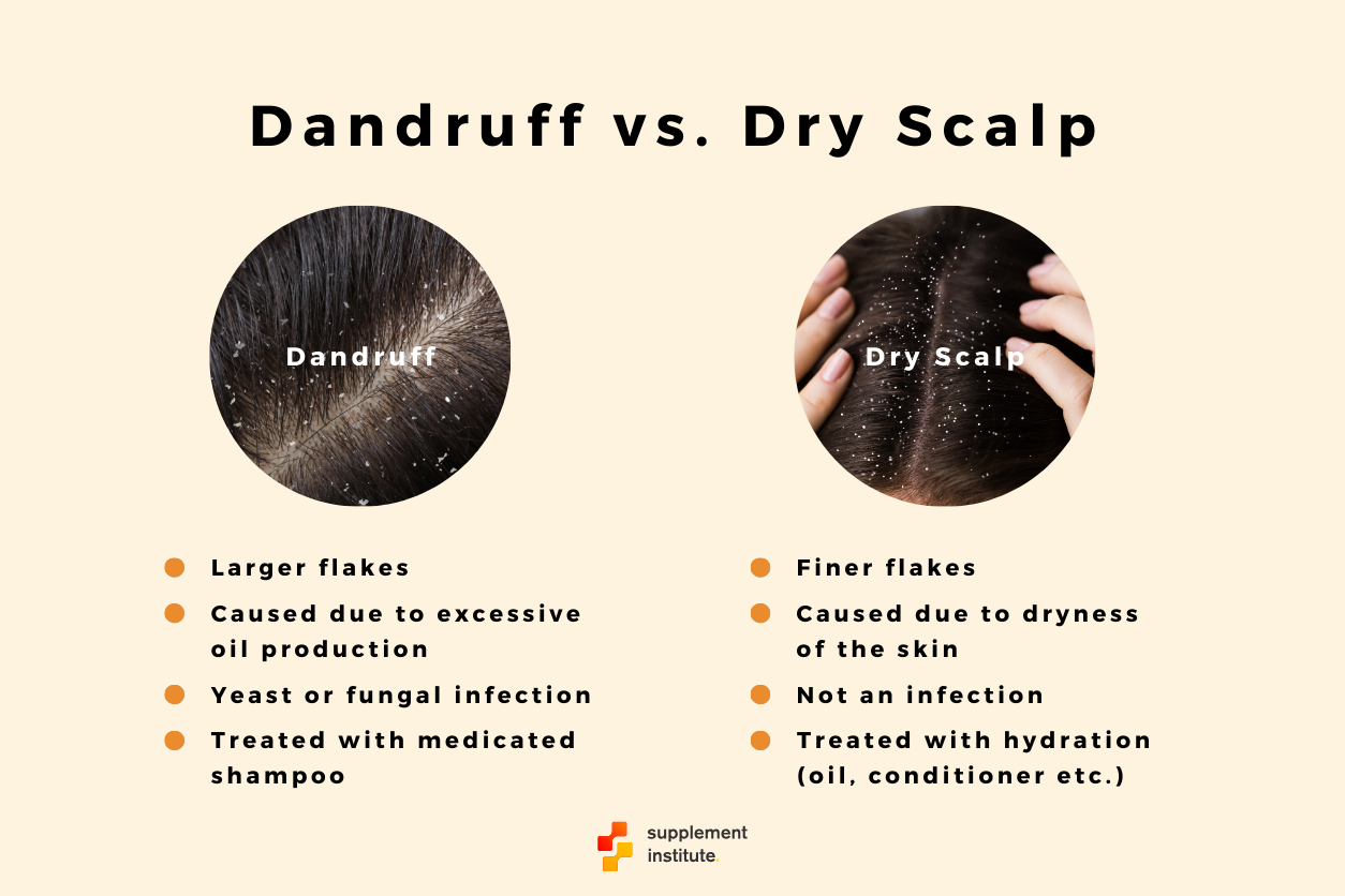 scalp treatment for dandruff